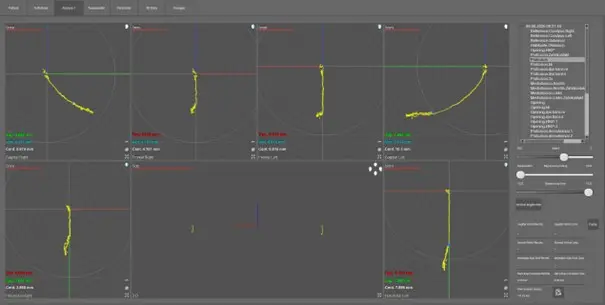 Auswertung der CMD-Funktionsanalyse